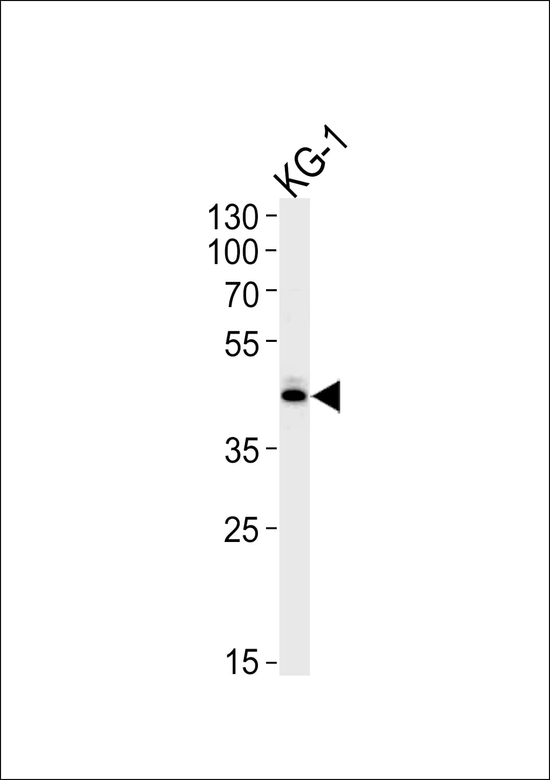 SIRT3 / Sirtuin 3 Antibody (aa250-279)