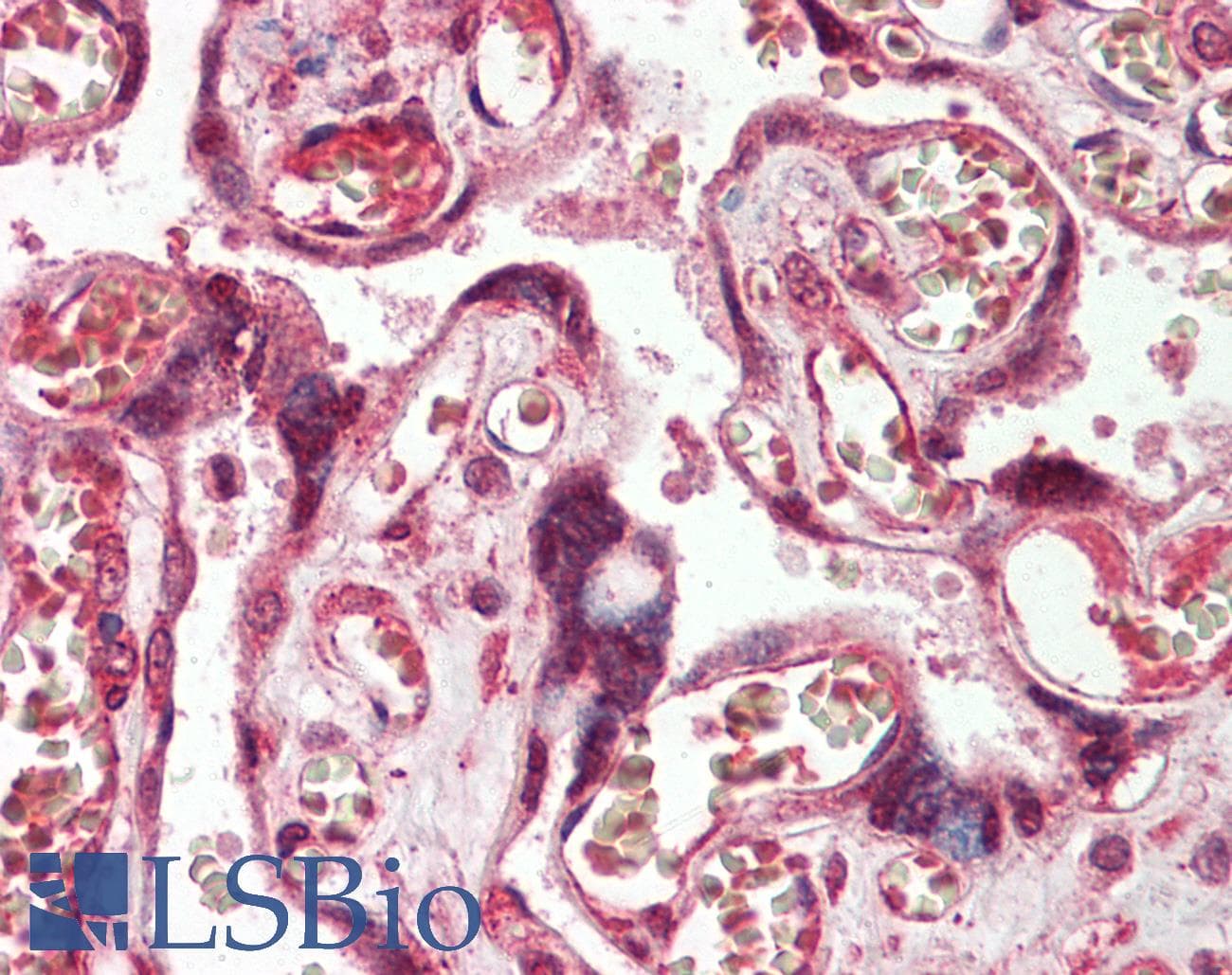 IHC-plus™ Polyclonal Rabbit anti-Human ADAM19 Antibody (IHC, WB)