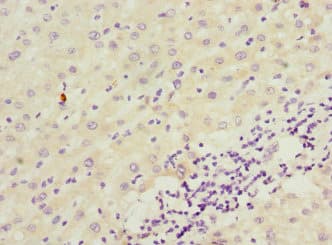 ICAM4 / CD242 Antibody