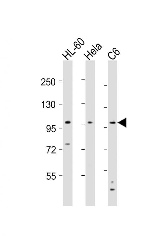 NCSTN / Nicastrin Antibody (aa99-133)