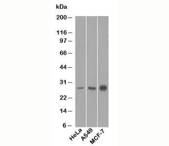 BCL2 / Bcl-2 Antibody (aa41-54, clone 8C8, Ready-to-Use)