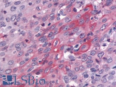 PathPlus™ Polyclonal Rabbit anti-Human GPR83 Antibody (Cytoplasmic Domain, IHC)