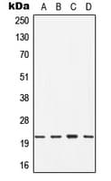 Polyclonal Rabbit anti-Human CDC42 Antibody (Internal, WB)