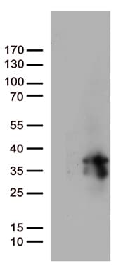 MGMT Antibody (clone OTI10H9)
