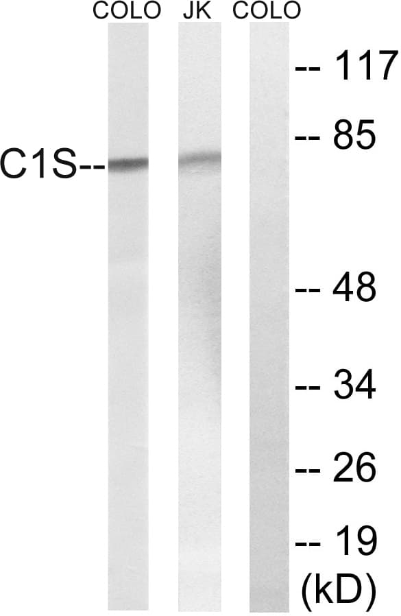 Polyclonal Rabbit anti-Human Complement C1s Antibody (aa541-590, IHC, WB)