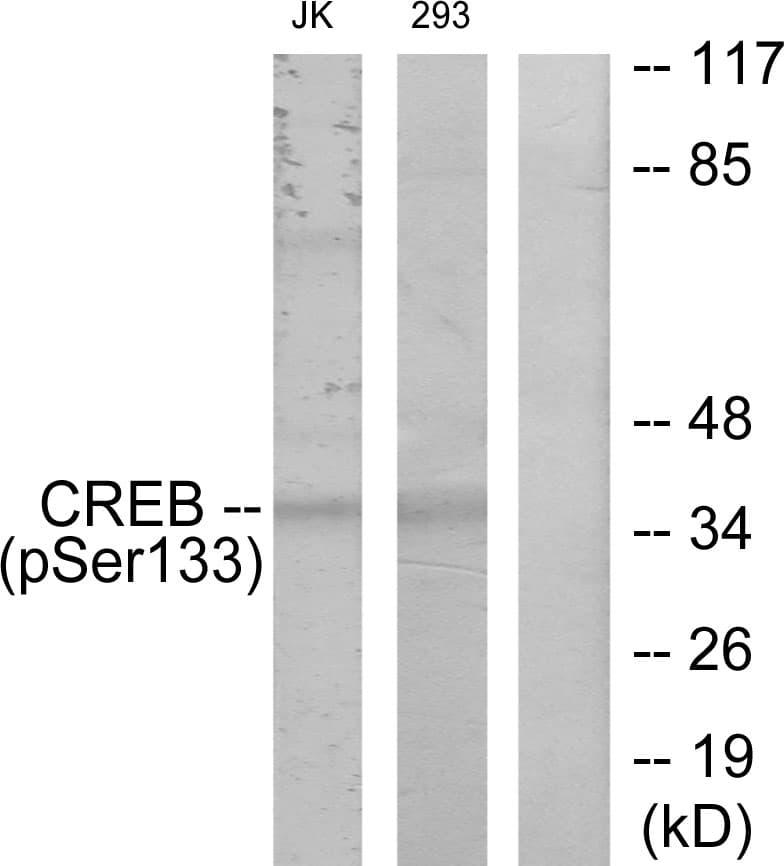 CREB1 / CREB Antibody (phospho-Ser133)
