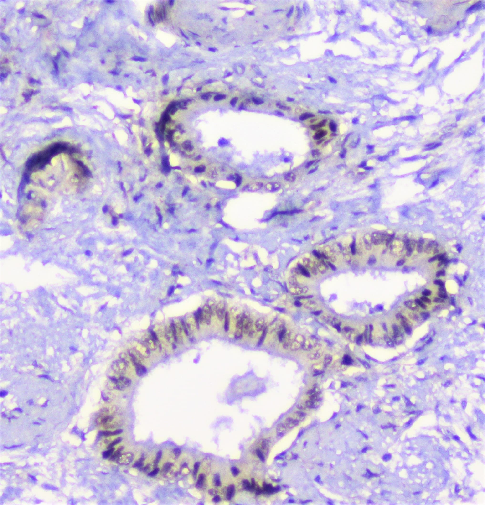 Properdin / CFP Antibody