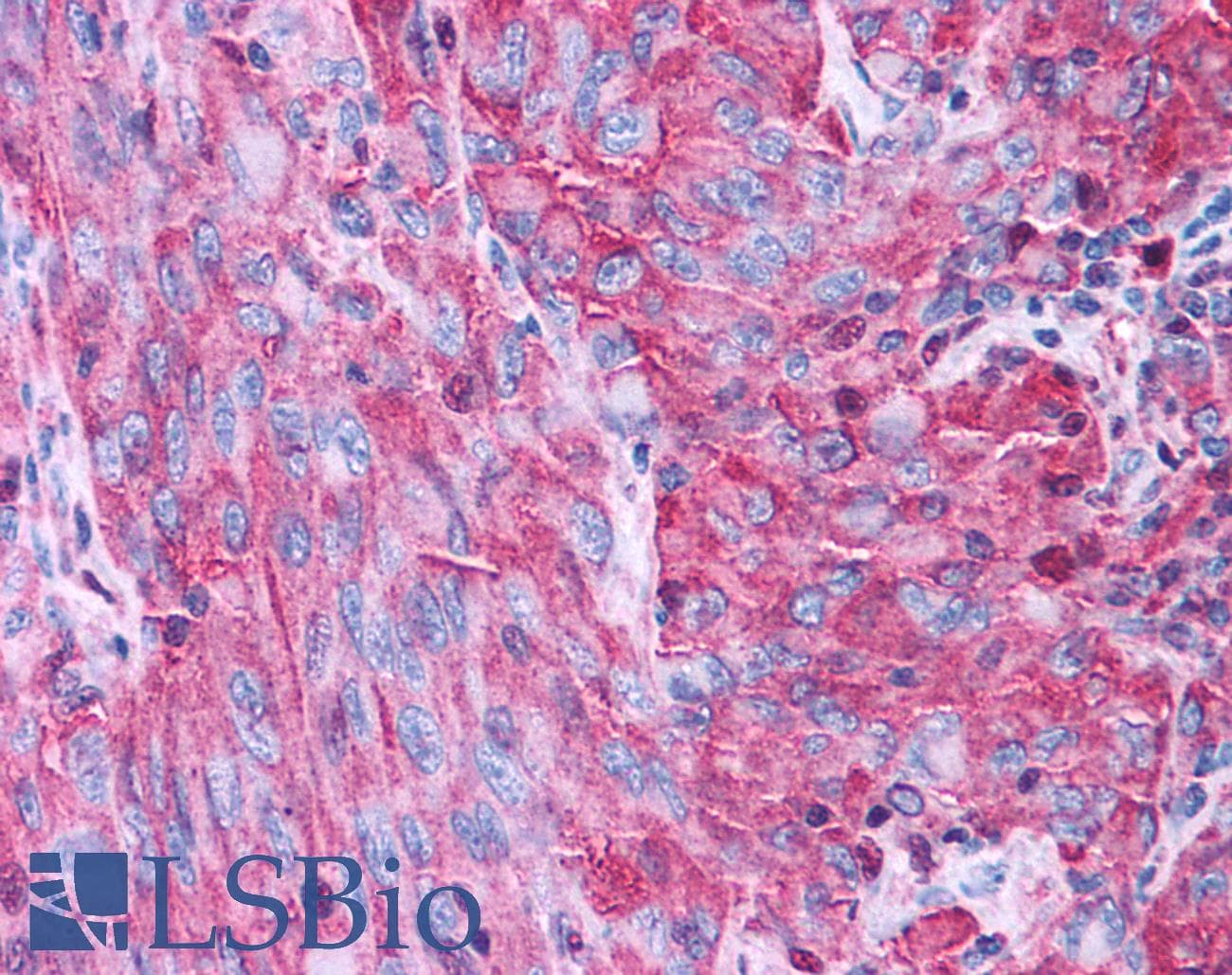 IHC-plus™ Polyclonal Rabbit anti-Human P2RY4 / P2Y4 Antibody (Cytoplasmic Domain, IHC)