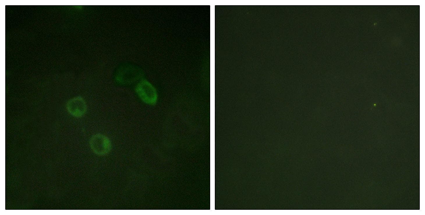 Polyclonal Rabbit anti-Human ERBB4 / HER4 Antibody (Ab-1284, IHC, IF)