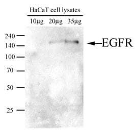 EGFR Antibody (clone AT2H8)
