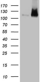 Monoclonal Mouse anti-Human EPLIN Antibody (clone OTI9F3, aa1-275, IHC, WB)