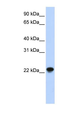 ARL8B Antibody (aa72-121)