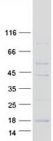 Human RBX1 / ROC1 Protein (Recombinant Myc-DDK (Flag))