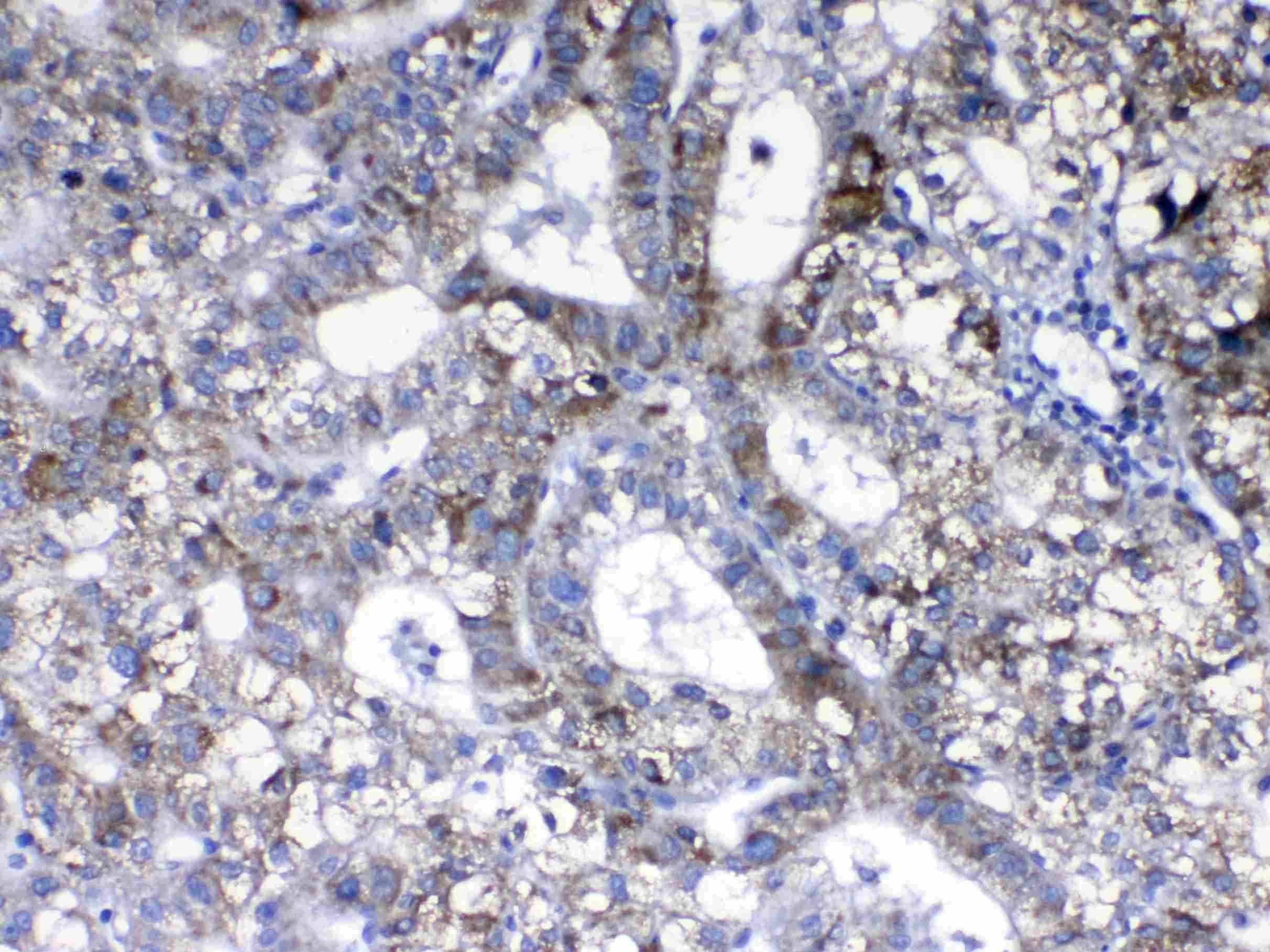 Polyclonal Rabbit anti-Human ERBB2 / HER2 Antibody (IHC, WB)