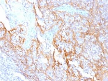 Monoclonal Mouse anti-Human CTNNB1 / Beta Catenin Antibody (clone 15B8, Azide-free,BSA-free, IHC, IF, WB)
