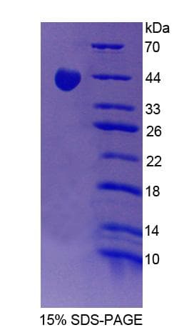 Rat PPP1R15A / GADD34 Protein (Recombinant His-T7)