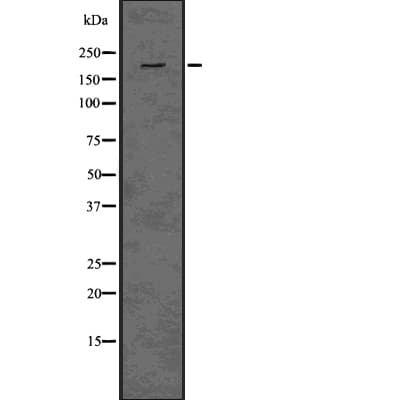 ERBB3 / HER3 Antibody (phospho-Tyr1289)