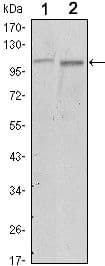 Monoclonal Mouse anti-Human FAK / Focal Adhesion Kinase Antibody (clone 10H7, IHC, IF, WB)