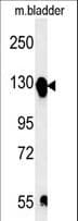Polyclonal Rabbit anti-Human ITGA5/Integrin Alpha 5/CD49e Antibody (aa796-822, WB)
