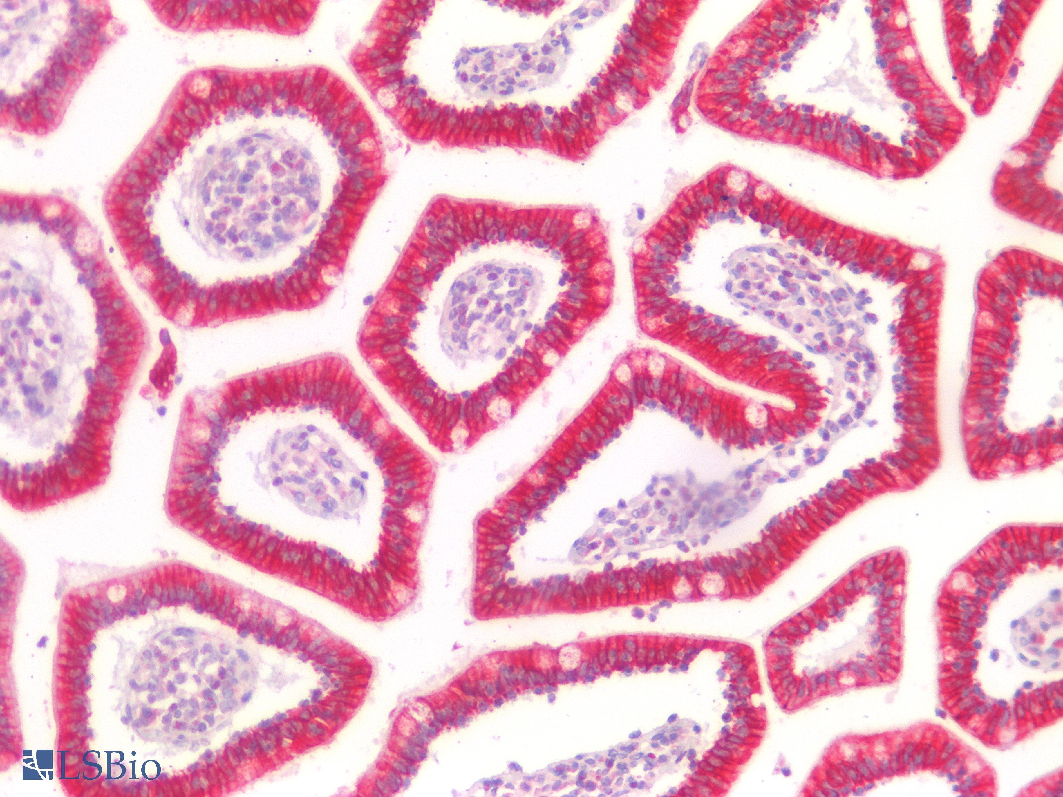 PathPlus™ Polyclonal Rabbit anti-Human KRT20 / CK20 / Cytokeratin 20 Antibody (IHC)