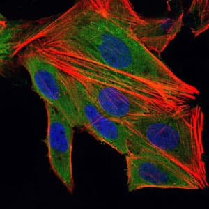 Monoclonal Mouse anti-Human IL-1B / IL-1 Beta Antibody (clone 3A6, IHC, IF, WB)