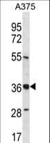 Polyclonal Rabbit anti-Human PIH1D1 Antibody (aa163-192, WB)