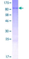 Human ASTE1 Protein (Recombinant GST)