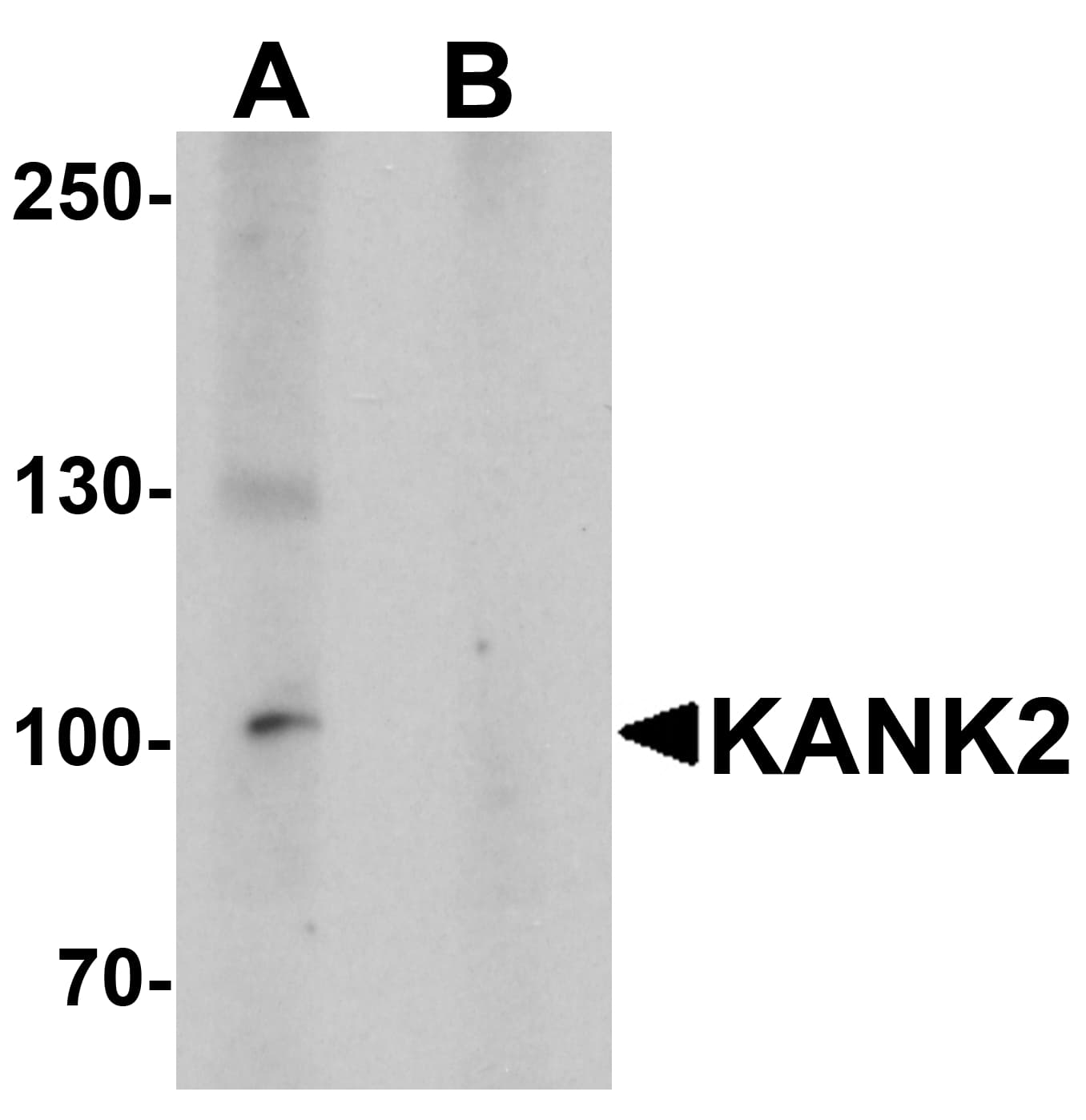 IHC-plus™ KANK2 Antibody