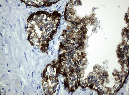 KRT19 / CK19 / Cytokeratin 19 Antibody (aa240-390, clone UMAB2)