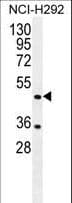 Polyclonal Rabbit anti-Human TRIM72 / MG53 Antibody (aa299-327, IHC, WB)