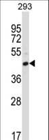 CD32C Antibody (aa260-288)