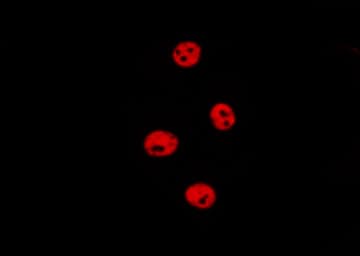 HIST3H3 Antibody (Methyl-Lys27)
