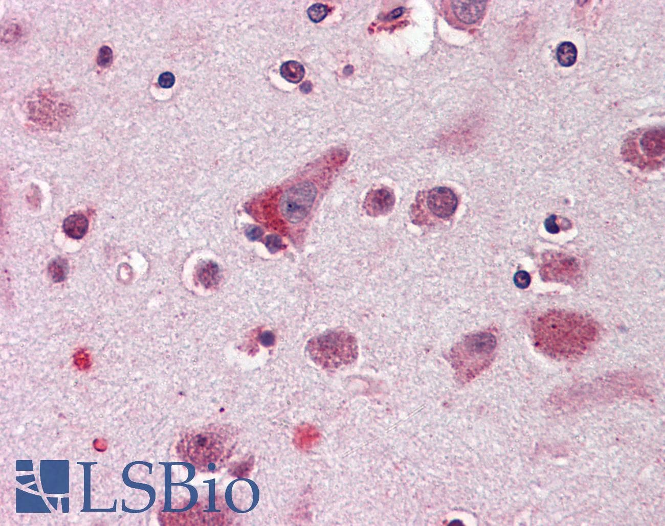IHC-plus™ Polyclonal Rabbit anti-Human HELO1 / ELOVL5 Antibody (Internal, IHC)