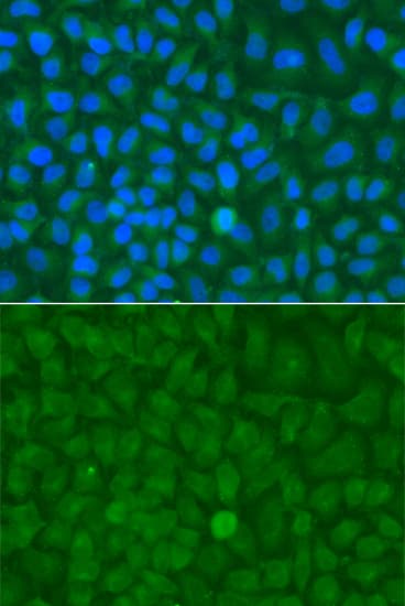 EPM2A / Laforin Antibody