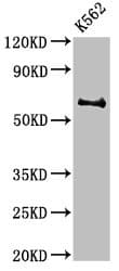 BCHE / Cholinesterase Antibody