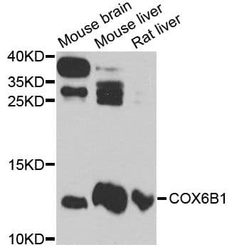 Polyclonal Rabbit anti-Human COXG / COX6B1 Antibody (WB)