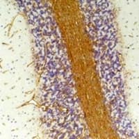 GABRA2 Antibody