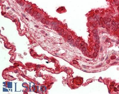 IHC-plus™ Polyclonal Rabbit anti-Human Carboxylesterase 1 / CES1 Antibody (IHC, WB)