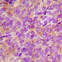 EGFR Antibody