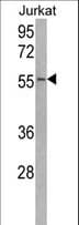 Polyclonal Rabbit anti-Human USP22 Antibody (aa351-380, IHC, WB)
