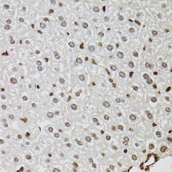 KDM4A / JHDM3A / JMJD2A Antibody