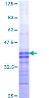 Human OX2R / Orexin Receptor 2 Protein (Recombinant GST, N-terminus)