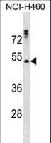 RHCG Antibody (aa184-213)