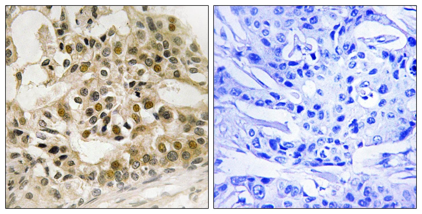 Polyclonal Rabbit anti-Human MYB / c-Myb Antibody (phospho-Ser532, IHC)