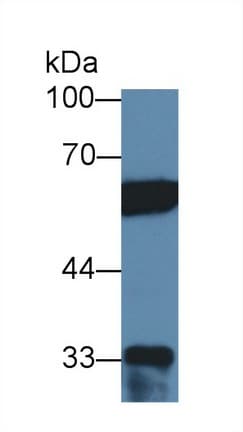 PTBP1 Antibody (aa1-531, PE)