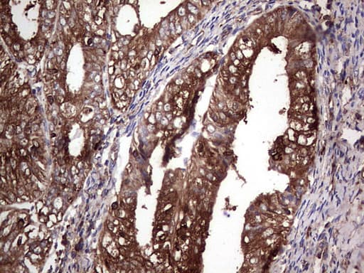 PKM2 Antibody (clone 12B9)