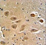 MICALL2 Antibody (aa841-870)