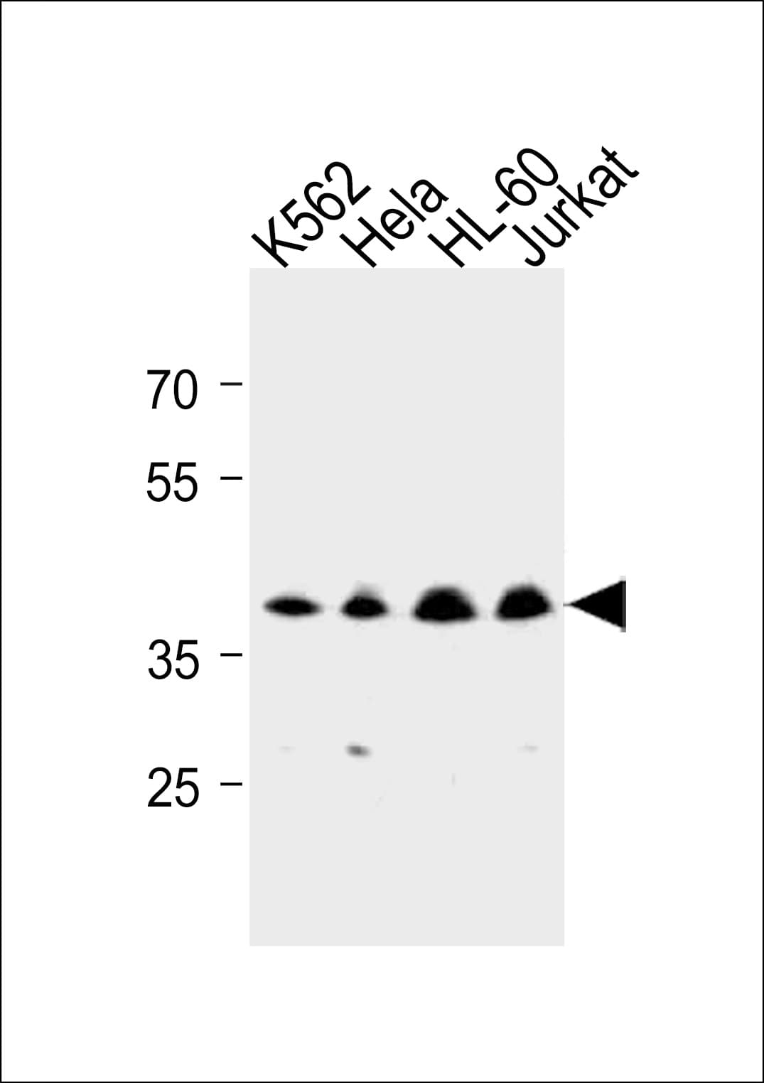 Polyclonal Rabbit anti-Human MECR Antibody (aa201-229, WB)