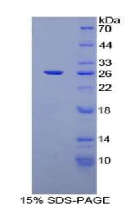 Human CD72 Protein (Recombinant His-T7)