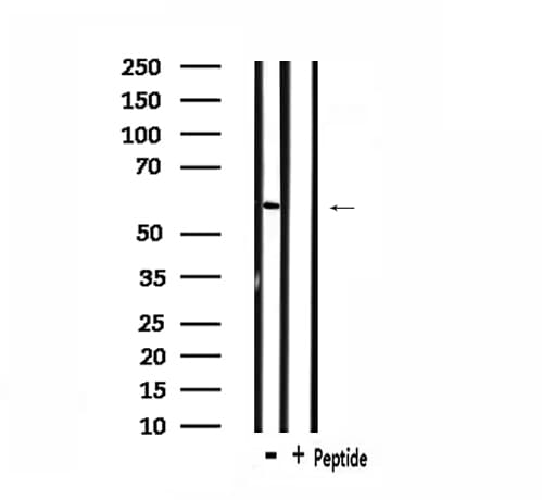 Polyclonal Rabbit anti-Human CSTF2 / CstF-64 Antibody (IF, WB)